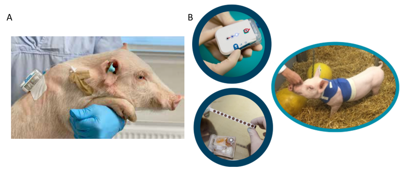 Metaboliten aus Dried Blood Spots